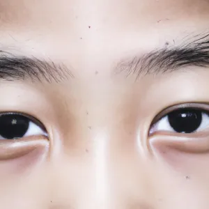 Dlaczego azjaci mają skośne oczy?